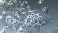 Jaarmayaan Fayyaa Addunyaa Dhukkubni Kaanserii Dabalaa Deemuu fi Zaambiyaa Keesstti Amaleeffannaan Dhugaatii Alkoolii Hammaachuu Gabaase 