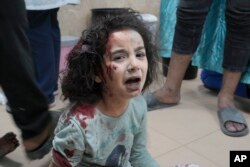 Palestinian child wounded in Israeli bombardment is brought to a hospital in Deir al Balah, south of the Gaza Strip, Nov. 2, 2023.