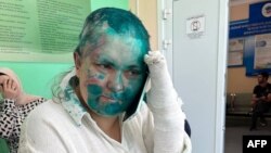 This handout picture released on July 4, 2023 by Sergei Babinets, the head of the Crew Against Torture, shows Russian investigative journalist Elena Milashina speaking on a mobile phone at a hospital in the Chechen capital Grozny. 