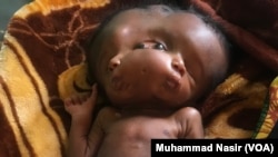 'Yan Biyu Maza Da Aka Haifa A Hade, Sokoto 