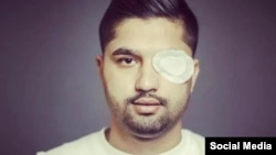 امیر ولایتی، معترضی که چشم خود را با شلیک گلوله ماموران حکومت در اعتراضات اخیر از دست داد.