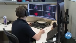 Sun'iy intellekt yordamida yurak kasalliklarini aniqlash