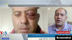 بهزاد همراهی از نابیناشدگان اعتراضات سراسر سال ۱۴۰۱ در ایران