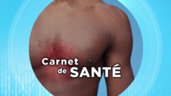Carnet de Santé : les maladies cardiovasculaires