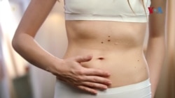 Генитално осакатување – насилство врз жените што навлегува и во Европа