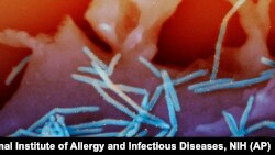 미 국립보건원(NIH)이 제공한 호흡기세포융합바이러스(RSV) 이미지 (자료사진)