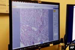 Ispitivanje ćelija svinjskog bubrega nakon biopsije (AP Photo/Shelby Lum)