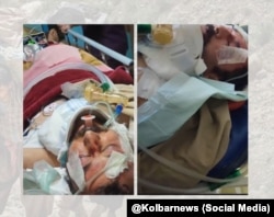 بهمن دوپلوره‌ای، کولبر اهل مریوان که بر اثر سقوط از ارتفاعات هورامان از ناحیه سر آسیب دچار آسیب شدیدی شده است