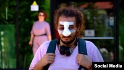 თავდასხმის შემდეგ, ბერძენიშვილს ცხვირის ოპერაცია დასჭირდა