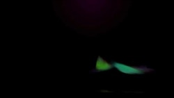  چودہ ماہ کا شہاب جس نے قرنیہ کی سرجری کے بعد پہلی بات اپنے والد کو دیکھا