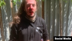 ზუკა ბერძენიშვილს სამი უცნობი პირი 11 ივნისს თბილისში გაუსწორდა, არცერთი მათგანი დაკავებული არ არის