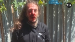 ზონდერების მეორე თავდასხმა ბოლო ოთხ დღეში: ზუკა ბერძენიშვილზე და ნიკო მანაგაძეზე