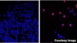 Netretirane ćelije raka (lijevo), ćelije tretirane s AOH1996 (desno). (Izvor: City of Hope)
