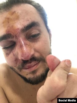 ბერძენიშვილი დაზარალებულად აღიარეს, თუმცა შსს მოპოვებულ მტკიცებულებებს არ აცნობს