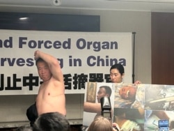 法轮功学员程佩明2024年7月3日在华盛顿举行的新闻发布会上展示活摘器官手术在其身体留下的一条长达35厘米的疤痕。（美国之音薛小山拍摄）