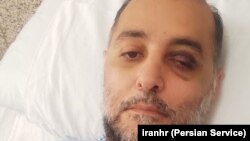 رضا عزتی،‌ یکی از اسیب‌دیدگان چشمی در اعتراضات ۱۴۰۱