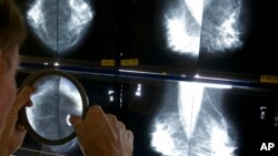 FILE - A radiologist uses a magnifying glass to check mammograms for breast cancer in Los Angeles, May 6, 2010. 