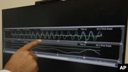 แฟ้ม - นพ.โรนีล มัลคานี ชี้ไปที่บันทึกคลื่นเสียงสีชมพู ที่ช่วยให้คลื่นสมองช้าลงระหว่างการนอนหลับลึก ที่ Center for Circadian & Sleep Medicine แห่ง Northwestern Medicine ในนครชิคาโก เมื่อ 16 พ.ค. 2024 (AP Photo/Laura Bargfeld)