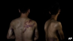 FILE - Afghan journalists Neamatullah Naqdi and Taqi Daryabi pose at a newspaper office after they were beaten by Taliban forces while covering a women's protest in Kabul on Sept. 10, 2021. Media groups on Aug. 11, 2023, demanded that the Taliban stop its crackdown on the press.