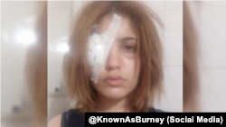 عسل جزیده، نوجوان قربانی شلیک عامدانه ماموران امنیتی جمهوری اسلامی به چشم معترضان