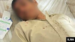 عکس دانش‌آموز مصدوم که خبرگزاری ایلنا منتشر کرده است.