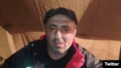 მოშიმშილე მაღაროელმა პროტესტის უკიდურეს ფორმას მიმართა და თვალები ამოიკერა