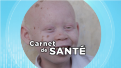 Carnet de santé : l’albinisme en Afrique