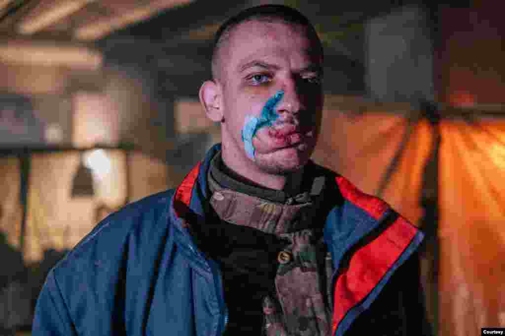 A wounded soldier inside the Azovstal steel plant. (Dmytro Kozatsky, Azov Regiment, Ukrainian National Guard)