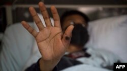 Au total, la variole du singe a officiellement causé la mort de 18 personnes dans le monde depuis mai.