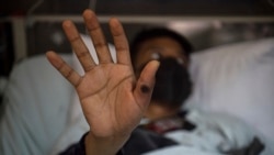 SML: Moto moko azwami na "Monkeypox" na lopitalo "Mama Yemo" ma Kinshasa