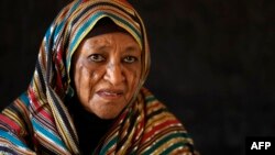 La scarification rituelle est une pratique ancienne partagée par de nombreuses communautés en Afrique.