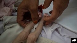 FILE - The stepmother of Mohammed, 4-month-old, who is malnourished, holds his legs in the Indira Gandhi hospital in Kabul, Afghanistan, Nov. 8, 2021.
