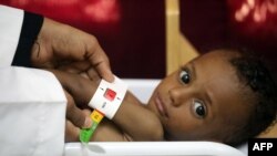 A nurse tends to a malnourished child at a treatment center in Yemen's western province of Hodeida on Feb. 15, 2022.