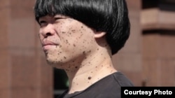 来自香港、现移居台北的濒死艺术家陈伟霖天生患有皮肤癌，全身长满黑色素肿瘤。(美国之音特约记者方琦拍摄)