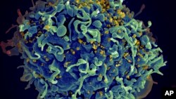 This colorized electron microscope image made available by the U.S. National Institutes of Health shows a human T cell, indicated in blue, under attack by HIV, in yellow, the virus that causes AIDS. (Seth Pincus, Elizabeth Fischer, Austin Athman/NIH via AP)