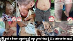 ရခိုင်ပြည်နယ်၊ ဂွမြို့နယ်မှာ ကလေးငယ်တွေနဲ့ အသက်ကြီးသူတွေ အဖြစ်များတဲ့ ယားနာရောဂါများကို တွေ့ရစဉ်