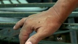 Florida Zika Cases Trigger Alarms in Washington