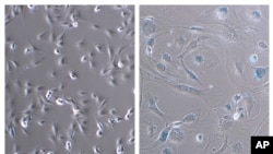 Zombie Cells-Healthy Aging