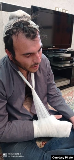 آثار شکنجه جلال ژاله، معترض بازداشت شده در کرمانشاه