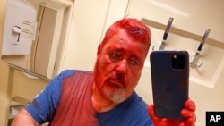  Nobel Peace Prize-winning editor Dmitry Muratov takes a selfie after he was attacked on a Russian train by an assailant who poured red paint on him, April 7, 2022. (Novaya Gazeta Europe's Telegram channel via AP)