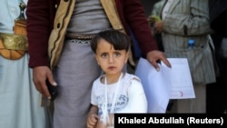 Seorang anak laki-laki tampak menatap kamera ketika ia berjalan keluar sehabis menjalani perawatan dari klinik patah tulang di daerah Sanaa, Yaman, pada 14 Oktober 2021. (Foto: Reuters/Khaled Abdullah)