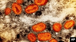 მაიმუნის ყვავილის უჯრედული გამრავლება. ფოტო - NIAID - შეერთებული შტატების ალერგიების და ინფექციურ დაავადებათა ეროვნული ინსტიტუტი 