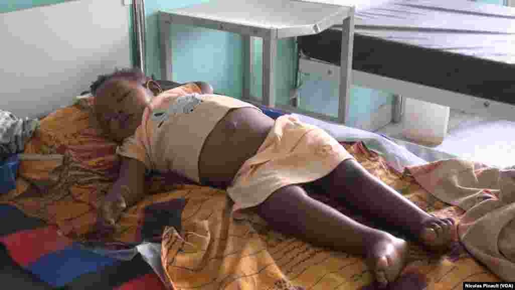 Cette petite fille souffre de malnutrition et présente de nombreux œdèmes au centre régional de santé mère enfant de Diffa, Niger, le 18 avril 2017 (VOA/Nicolas Pinault)
