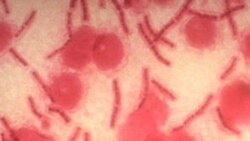 Bakteria aina ya Kimeta yaani Anthrax 