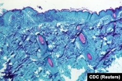 Sepotong jaringan kulit, diambil dari lesi pada kulit monyet, yang telah terinfeksi virus cacar monyet, terlihat pada pembesaran 50X pada hari keempat perkembangan ruam pada 1968. (Foto: via Reuters)