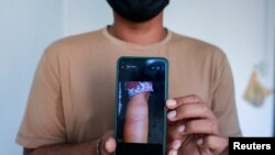 Lin Lin Bo Bo, whose parents cut ties with him, shows a picture of his mother's wounds due to military supporters beating her, Jan. 26, 2022
