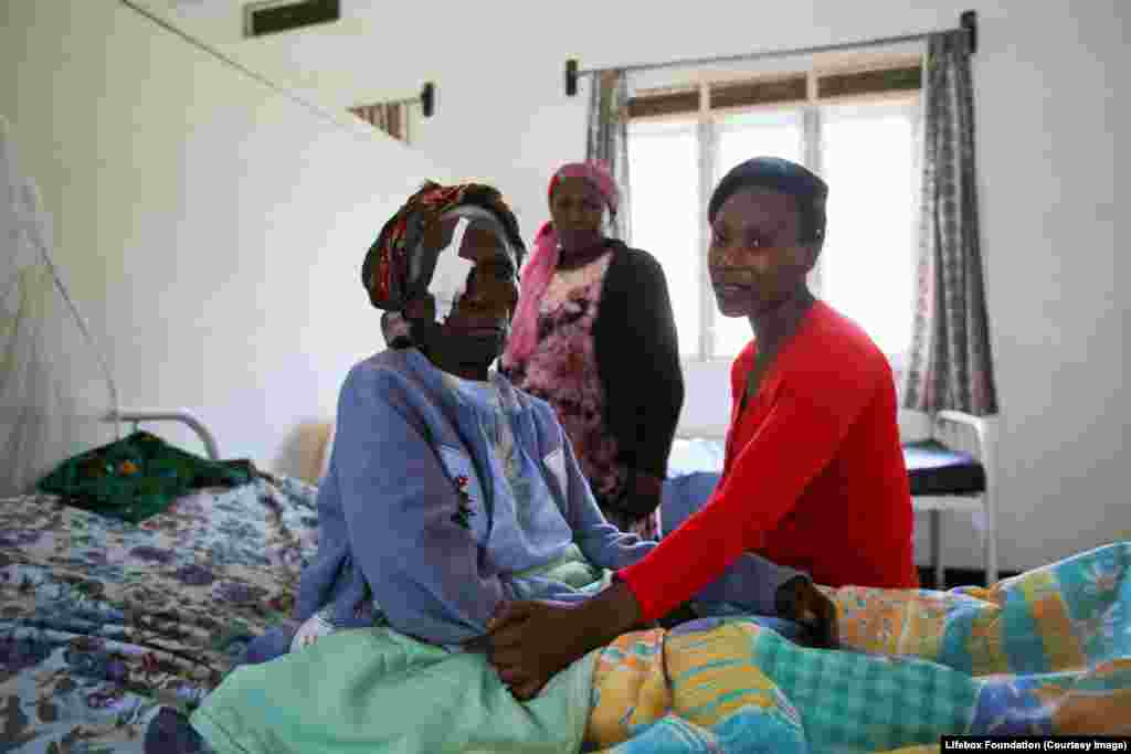 Family taking care of elderly patient recovering from eye surgery.