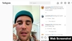 Justin Bieber montre sa paralysie du visage à ses fans sont son compte Twitter.