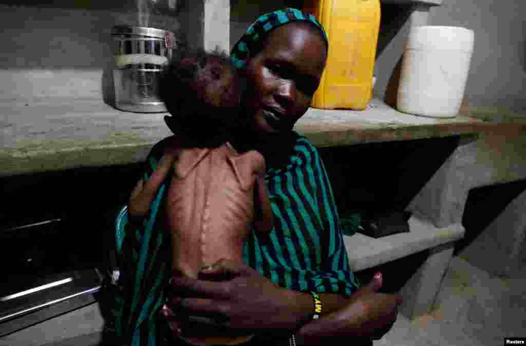 A mother holds her severely malnourished child at the pediatric ward of the Mother of Mercy Hospital in Gidel, South Kordofan, Sudan, June 25, 2024.
