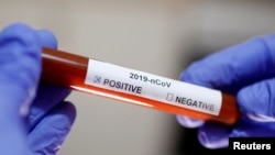 Epruveta sa testom na koronavirus